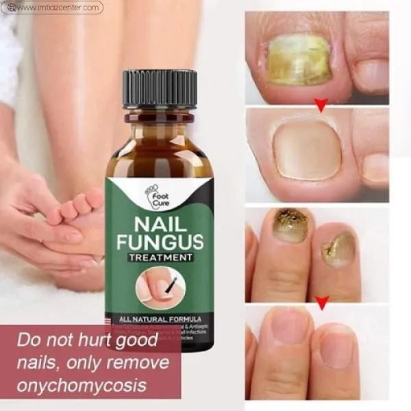 Jemeesen Fungus Removal Serum